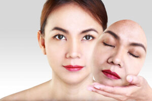 Nâng cơ trẻ hóa da - Bí quyết níu kéo nét thanh xuân cho chị em phụ nữ